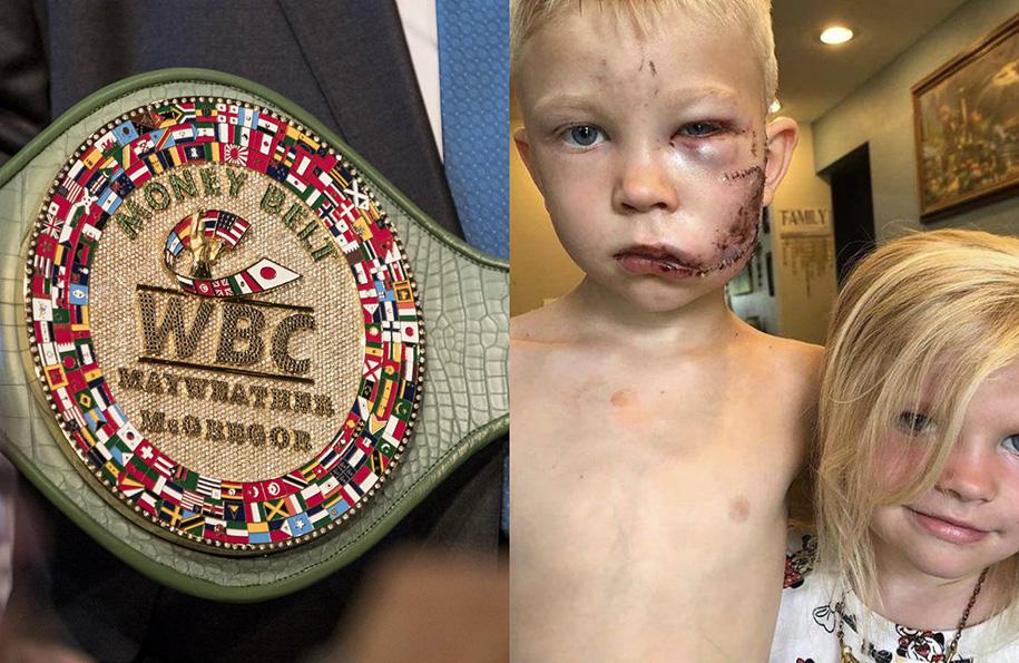 WBC trao đai vô địch Boxing cho bé trai 6 tuổi cứu em gái khỏi chó dữ